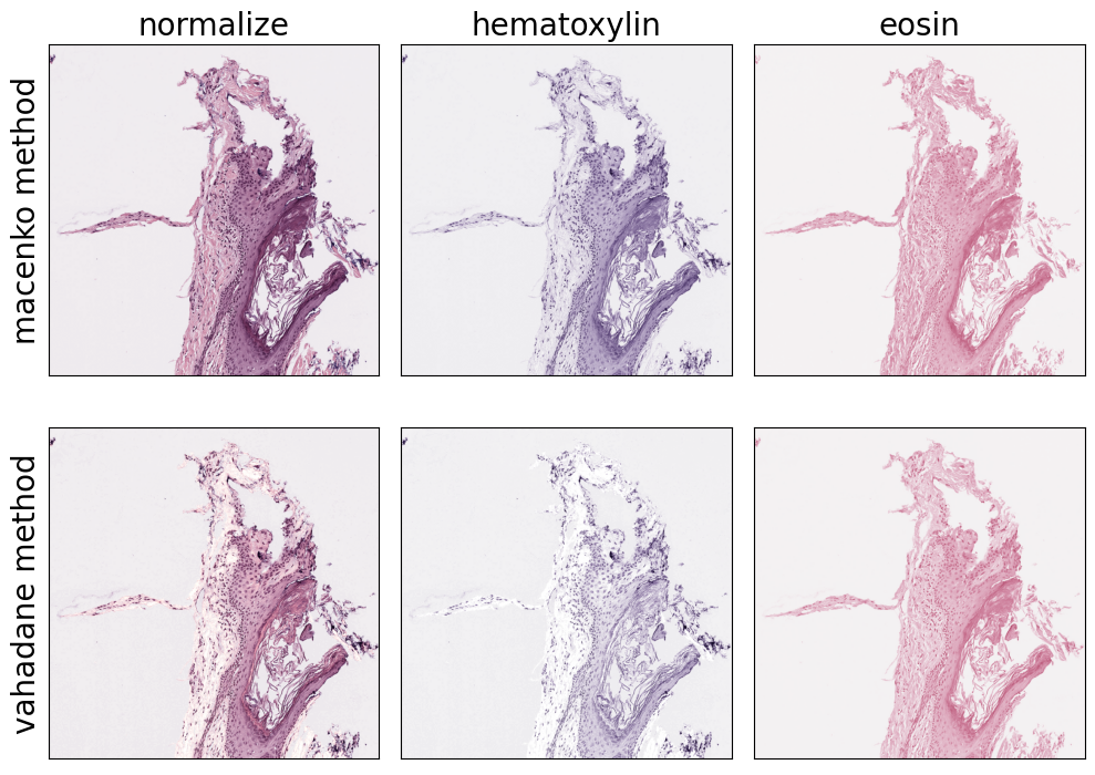../_images/examples_link_stain_normalization_10_0.png
