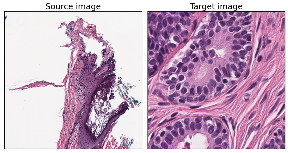 ../_images/examples_link_stain_normalization_6_0.png