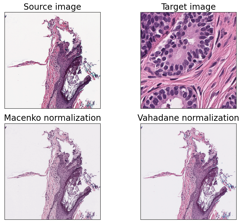 ../_images/examples_link_stain_normalization_8_0.png